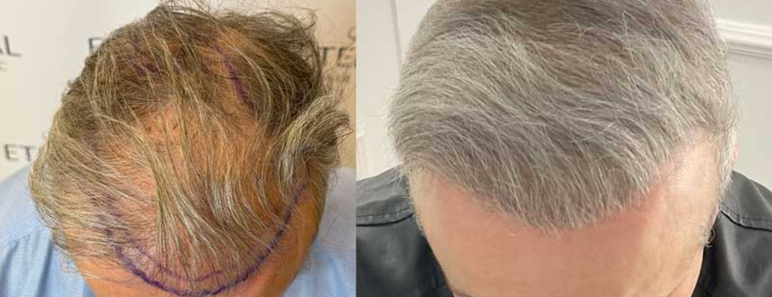Eternal Hair Clinic - Imagen 3