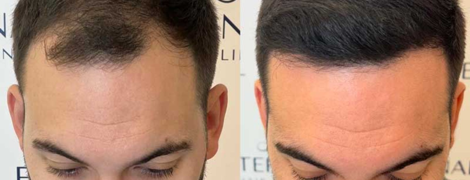 Eternal Hair Clinic - Imagen 4