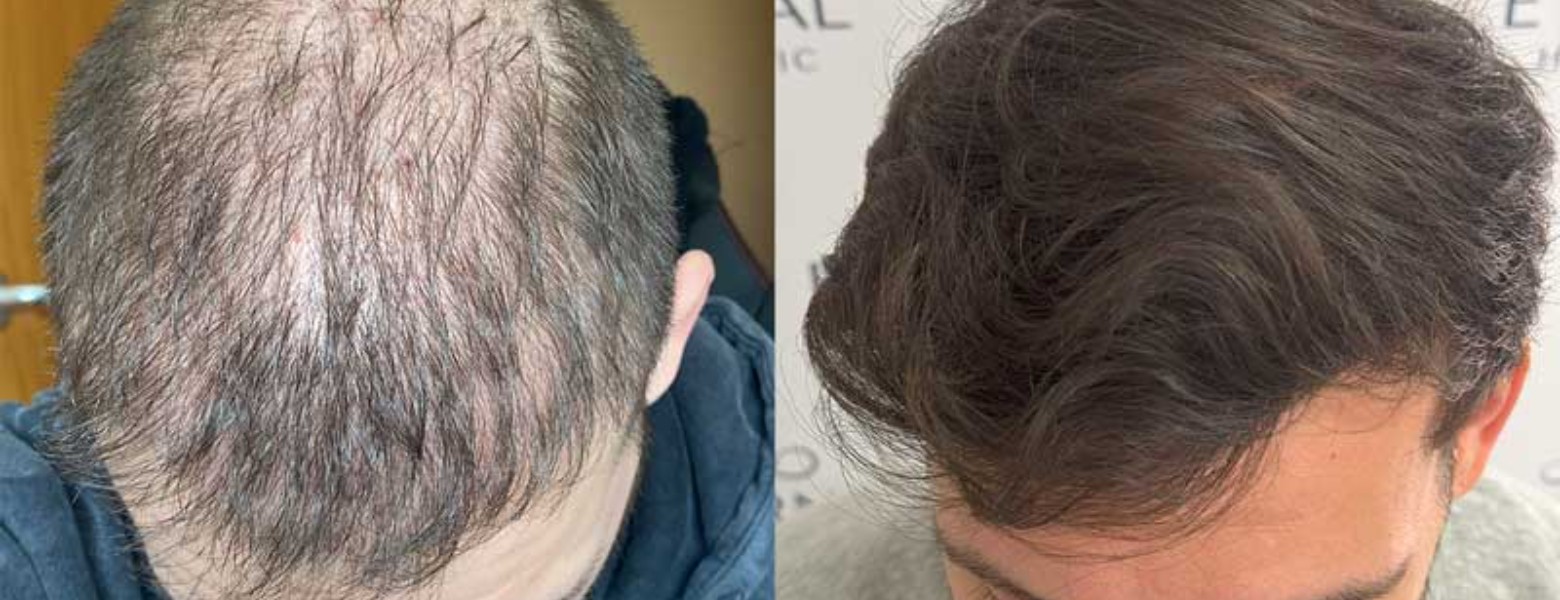 Eternal Hair Clinic - Imagen 2