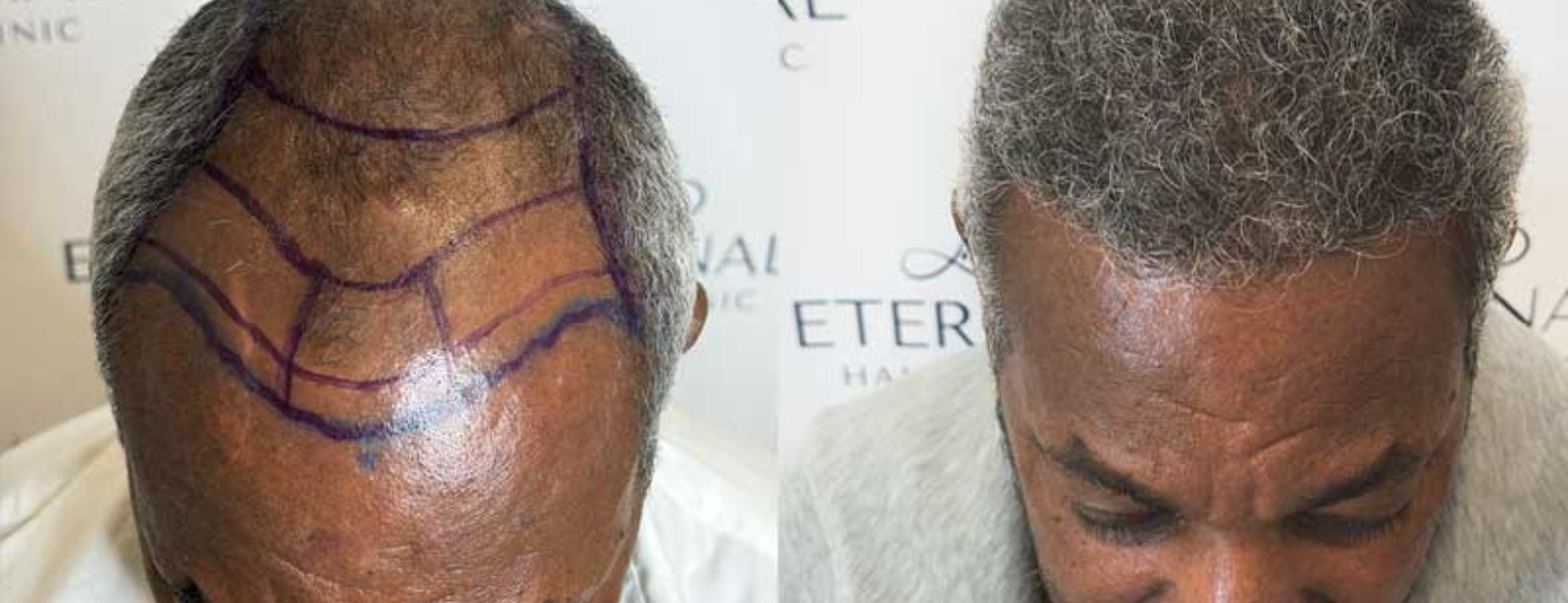 Eternal Hair Clinic - Imagen 5