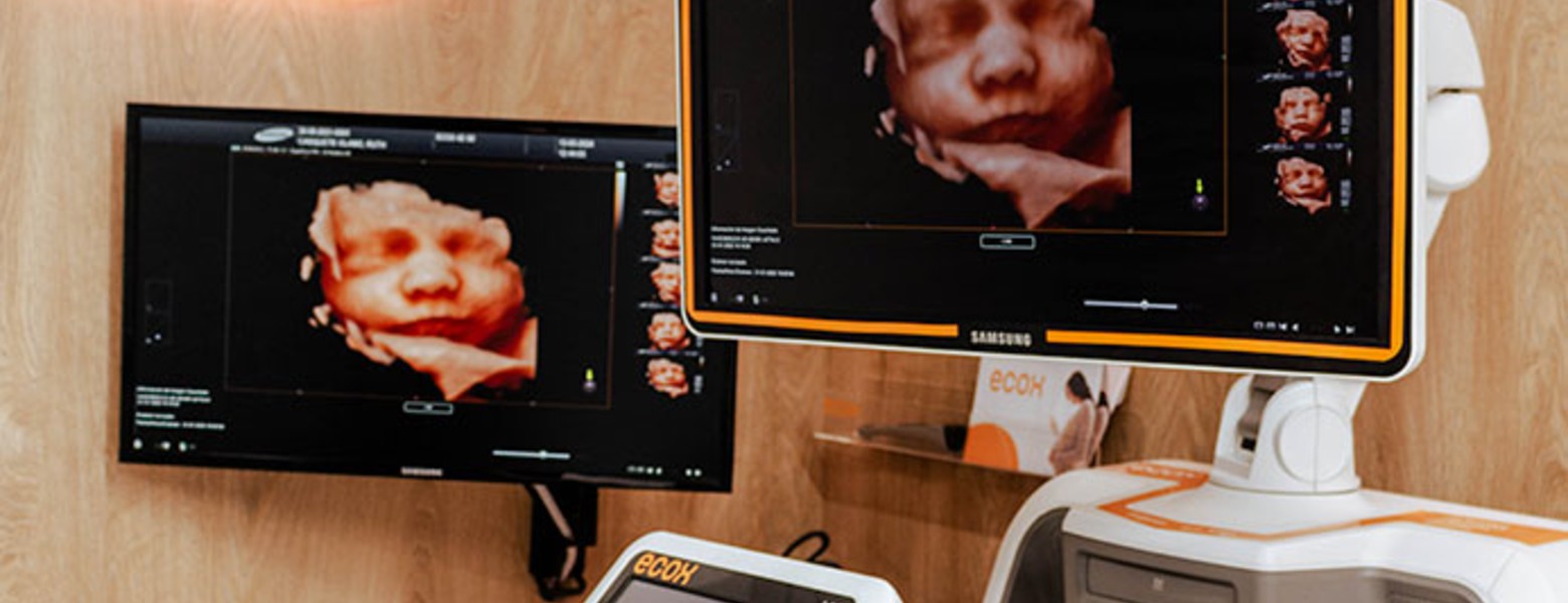 Ecox Inca, Mallorca | Especialistas en ecografías 5D, 4D y 8K - Imagen 1