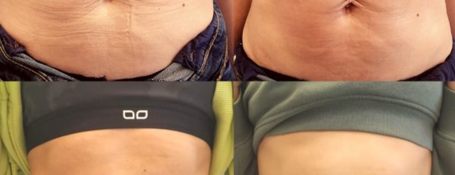 Policlinica en Toledo • MMC CLINIC CENTER - Imagen 3