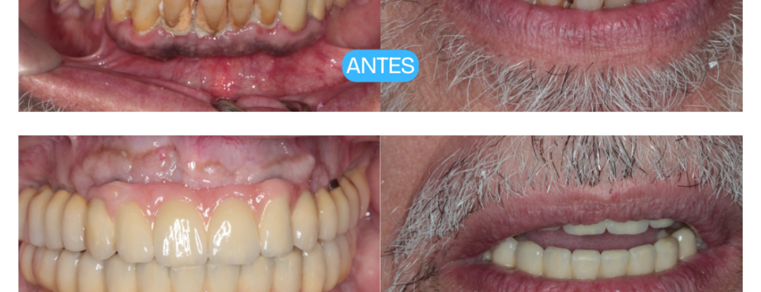 Clínica Dental Casher - Dentista Alicante - Imagen 5