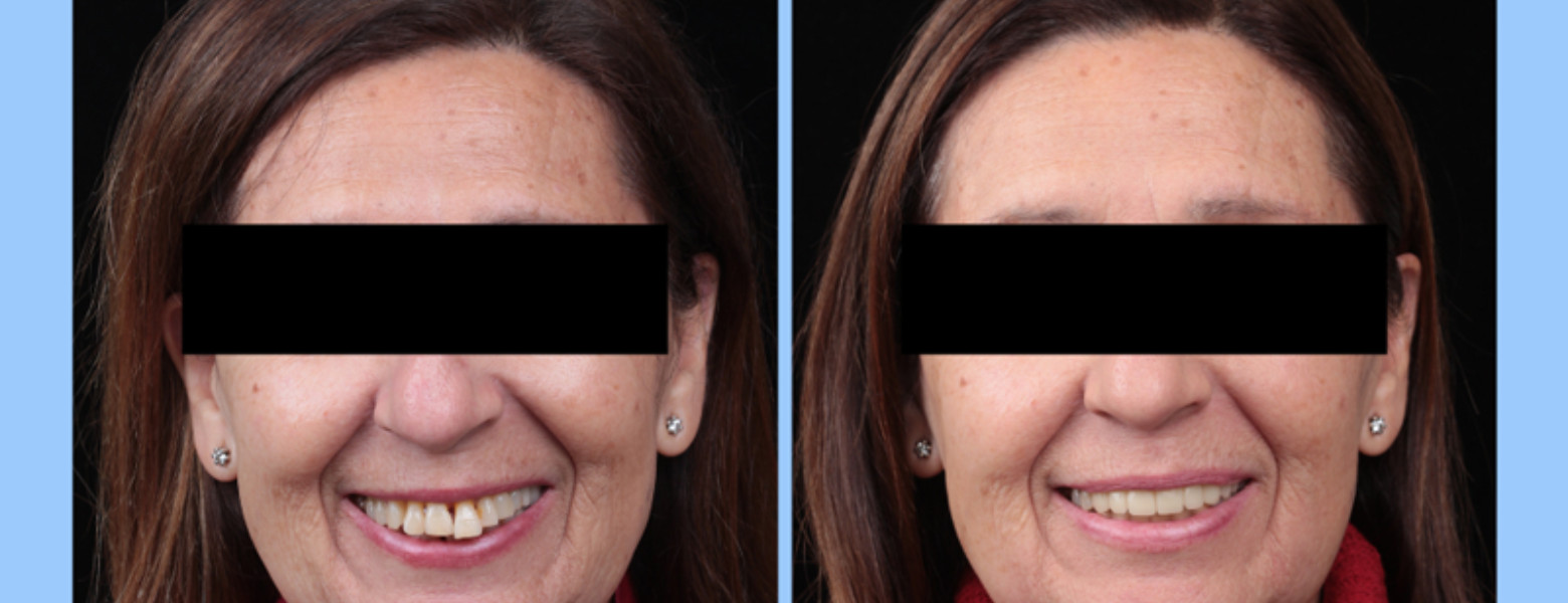 Clínica Dental Casher - Dentista Alicante - Imagen 2