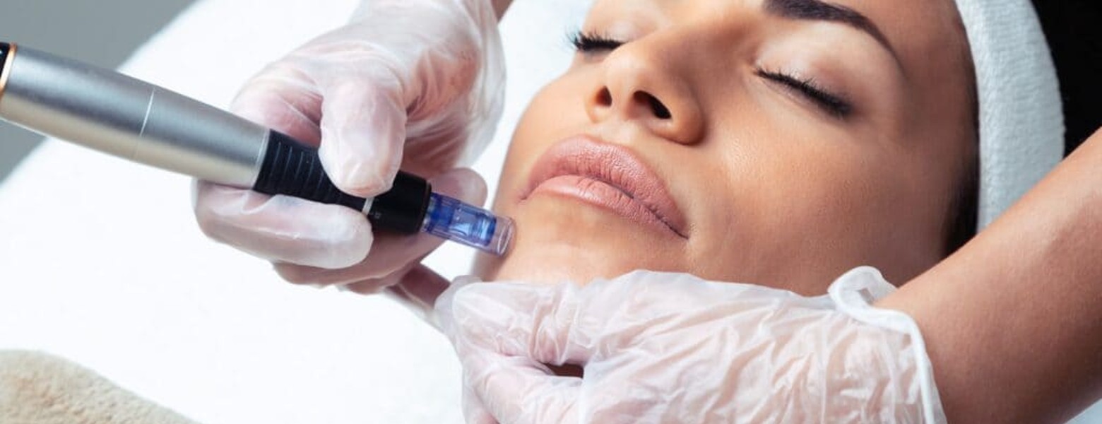 Bienve Nuevo - Imagen 1