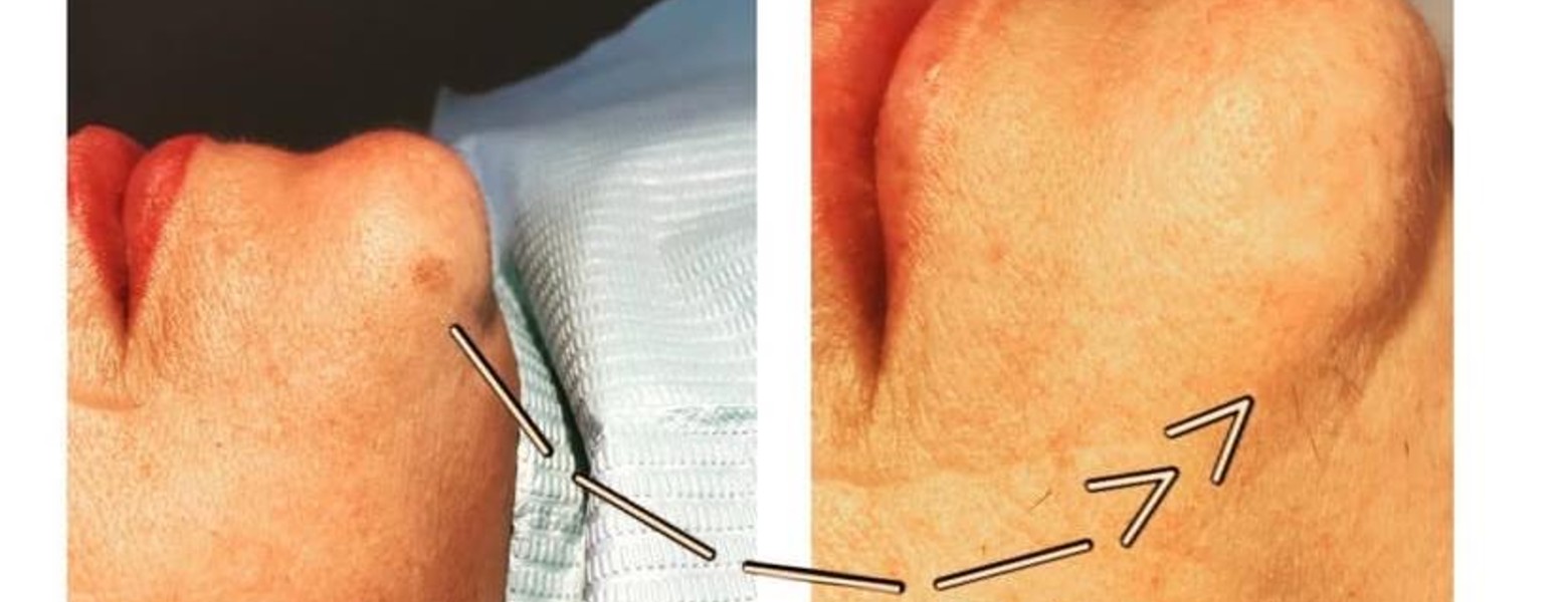 PESTAÑA DONNA ESTÉTICA | Extensiones de pestañas en Sevilla | Micropigmentación - Imagen 4