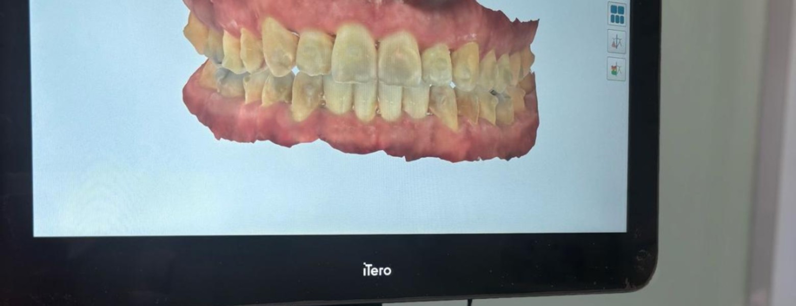 Acedo Dental Seseña - Imagen 3