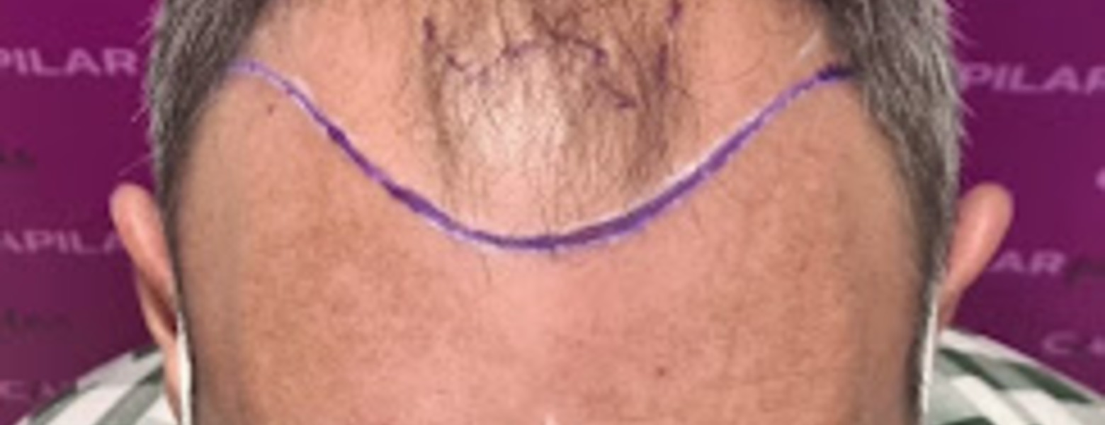 Foto de Capilar Plus en Dos Hermanas - Imagen 1