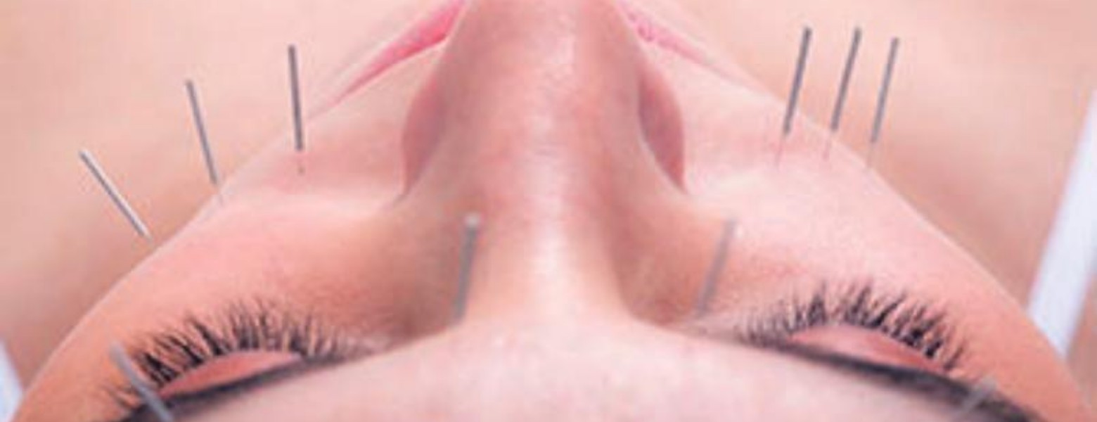 Clínica Acupuntura Beltrán Carrillo - Imagen 1