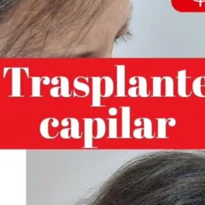 Foto de Clínicas Dr Pelo Trasplante y Medicina Capilar en Sevilla - Imagen 2
