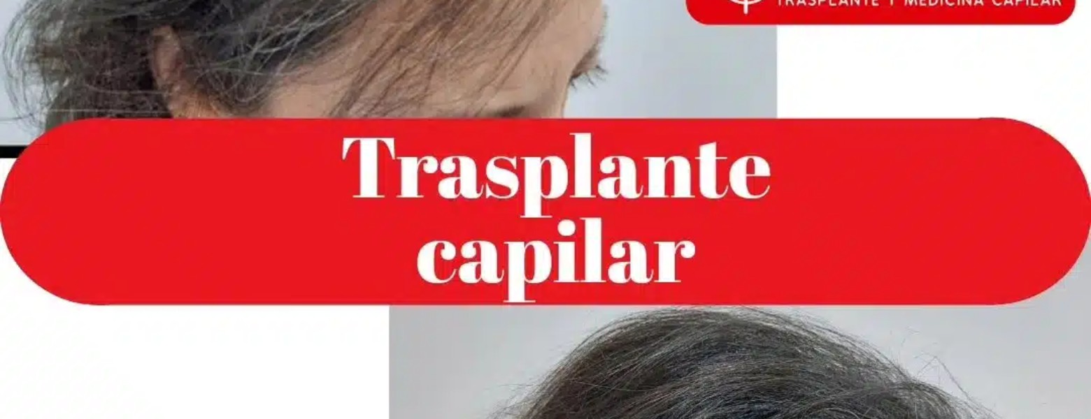 Foto de Clínicas Dr Pelo Trasplante y Medicina Capilar en Sevilla - Imagen 2