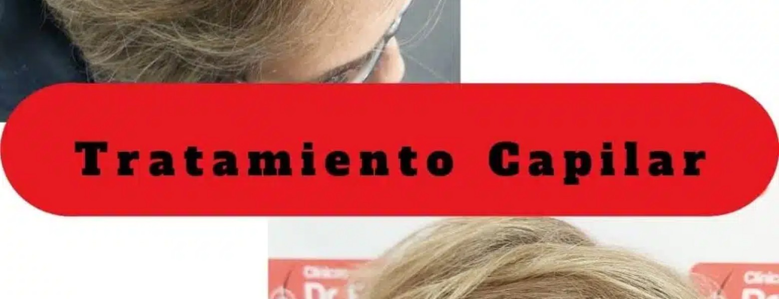 Foto de Clínicas Dr Pelo Trasplante y Medicina Capilar en Sevilla - Imagen 3