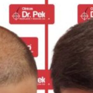 Foto de Clínicas Dr Pelo Trasplante y Medicina Capilar en Sevilla - Imagen 5