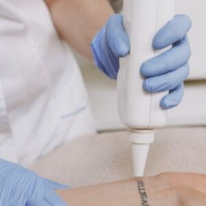 Foto de Remove Málaga Eliminación de Tatuajes en Málaga - Imagen 4