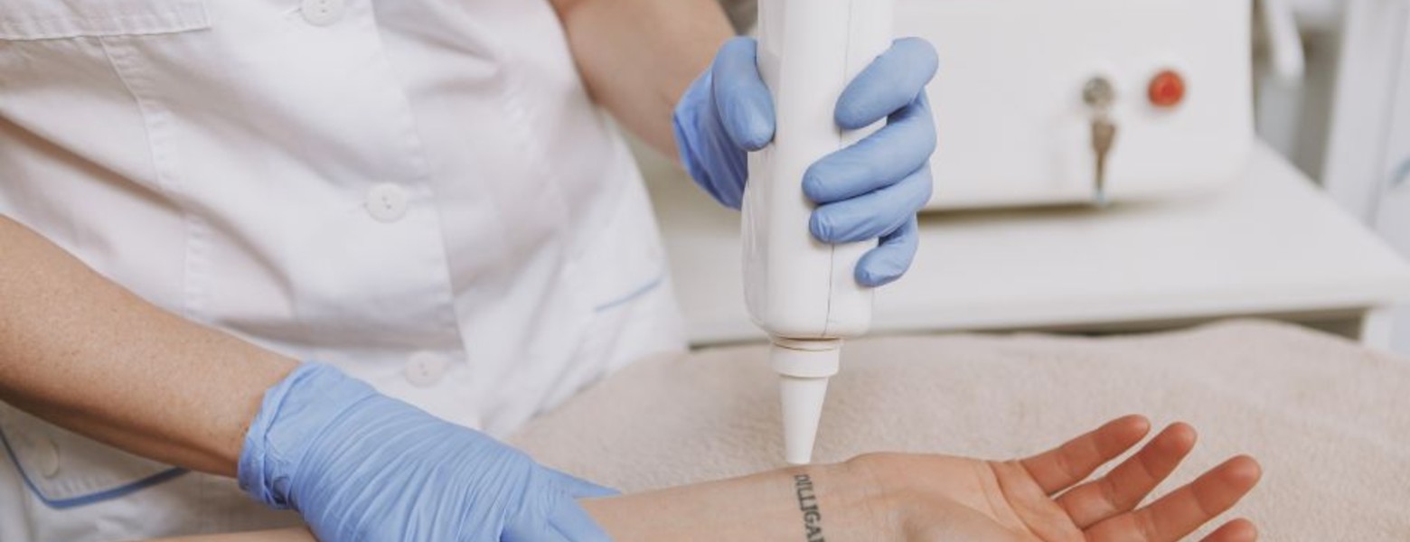 Foto de Remove Málaga Eliminación de Tatuajes en Málaga - Imagen 4