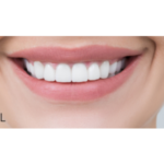 Clínica Dental Cote | Dentista Vallecas - Dentista en Madrid