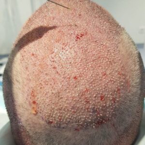 Foto de Aribelti en Barcelona - Imagen 2