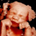 Ecobaby - Ecografías 5D - Imagen 1 - Negocio