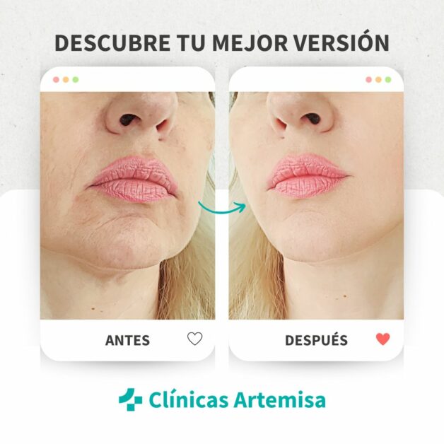 Clínicas Artemisa Sevilla - Imagen 4