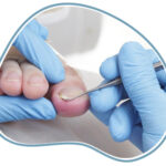 RM CLINIC Moratalaz - Imagen 2 - Clinica del pie en Madrid