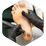 RM CLINIC Moratalaz - Imagen 5 - Clinica del pie en Madrid